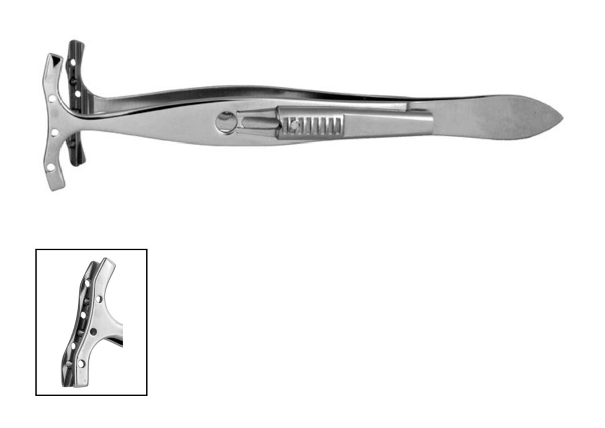 Putterman Muller's Muscle Conjunctival  Resection