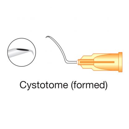 Cystotome