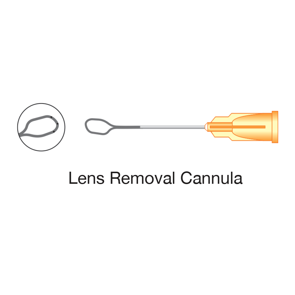 Lens Removal Cannula