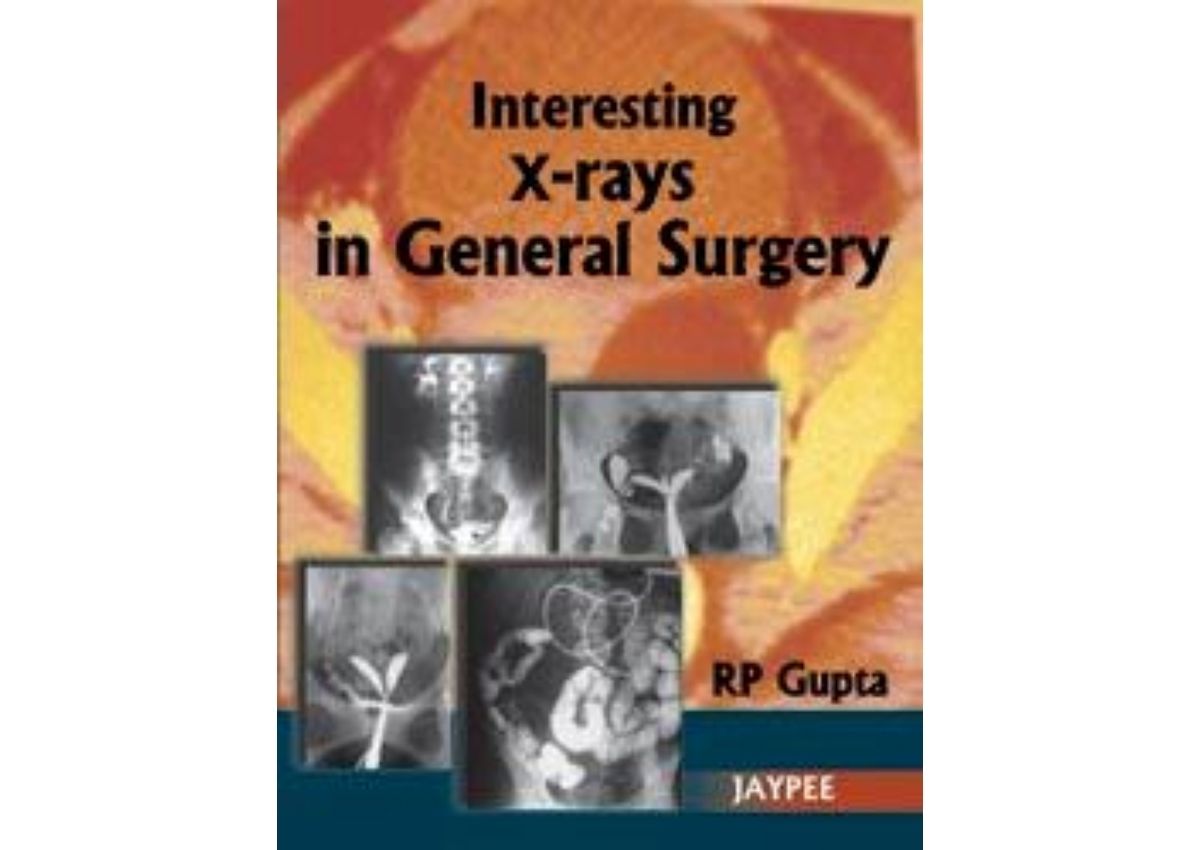Interesting X-Rays in General Surgery