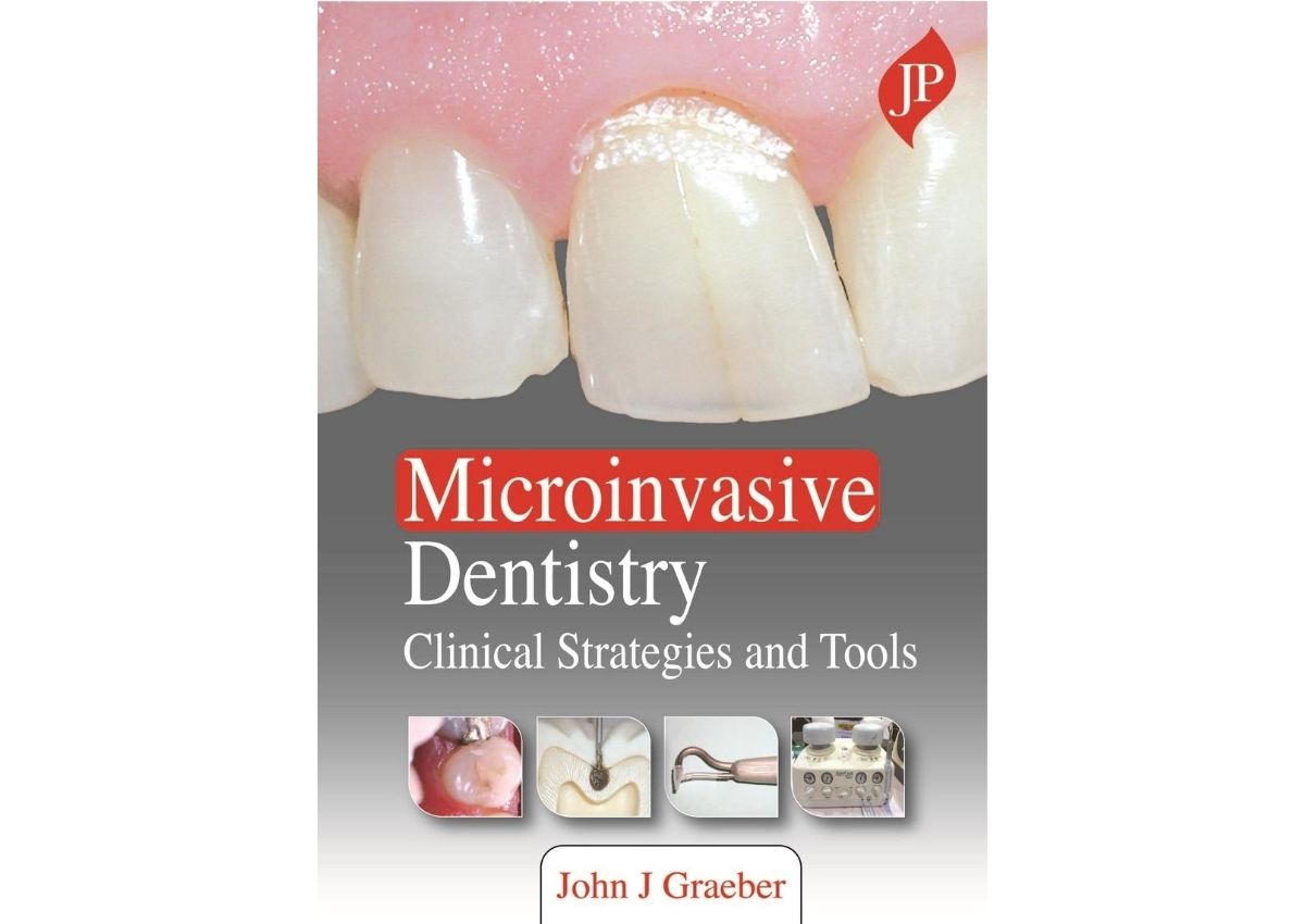 Microinvasive Dentistry: Clinical Strategies and T