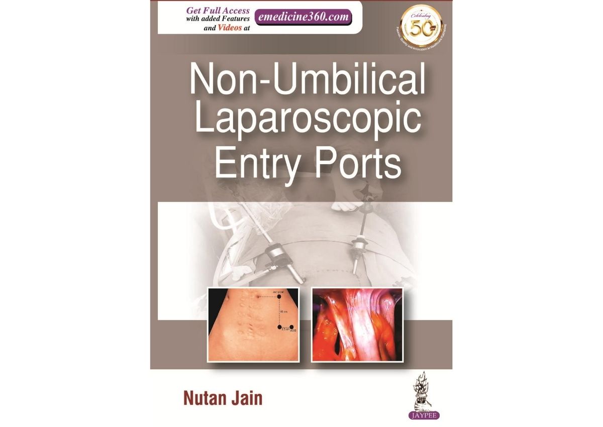 Non-Umbilical Laparoscopic Entry Ports