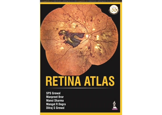 Retina Atlas