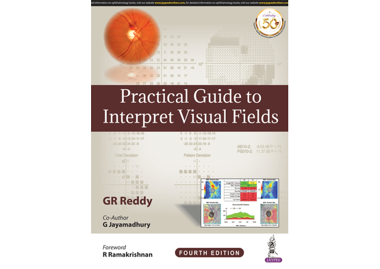 Practical Guide to Interpret Visual Field