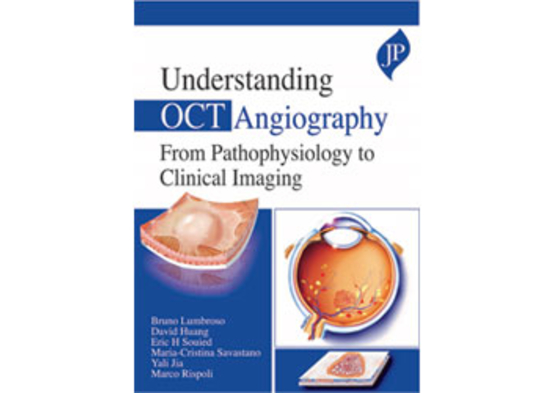 Understanding OCT Angiography: From Pathophysiolog