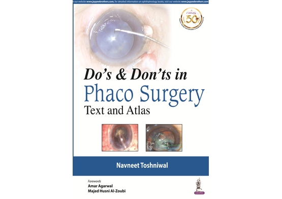 Do's & Dont's in Phaco Surgery