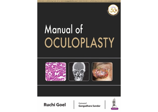 Manual of Oculoplasty