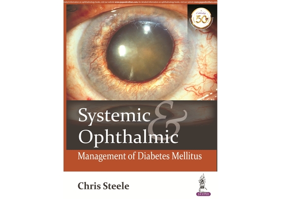Systemic & Ophthalmic Management of Diabetes Melli