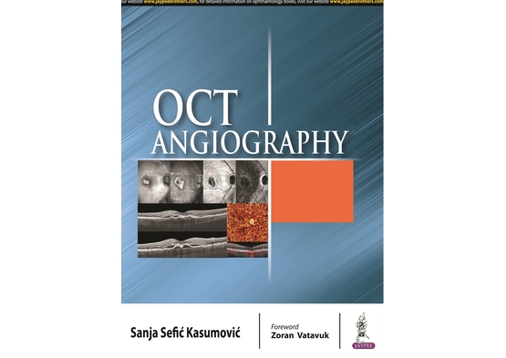 OCT Angiography