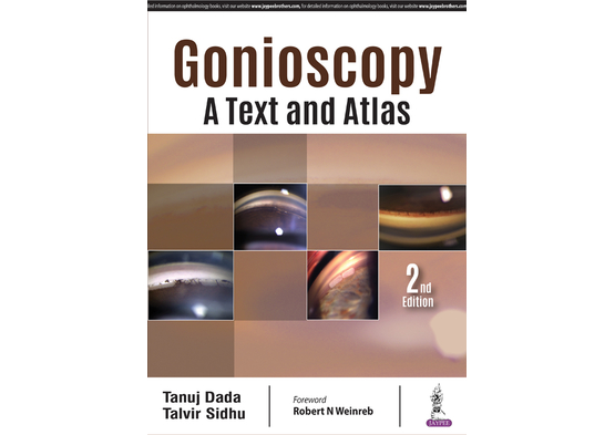 Gonioscopy: A Text and Atlas