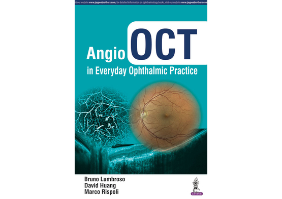 Angio OCT in Everyday Ophthalmic Practice