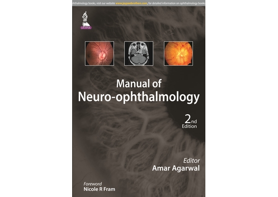 Manual of Neuro-ophthalmology