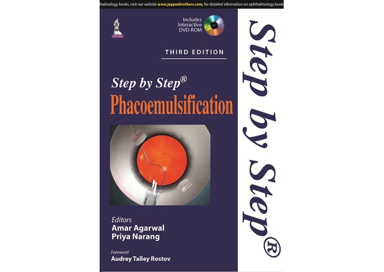 Step by Step Phacoemulsification