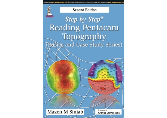 Step by Step: Reading Pentacam Topography