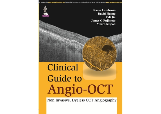 Clinical Guide to Angio-OCT: Non Invasive, Dyeless