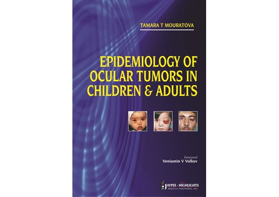 Epidemiology of Ocular Tumors in Children & Adults