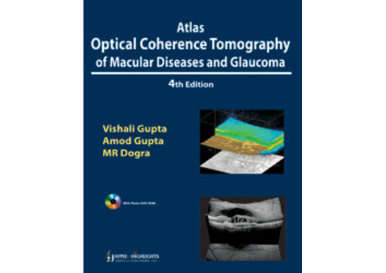 Atlas Optical Coherence Tomography of Macular Dise
