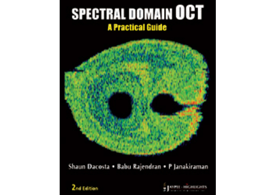 Spectral Domain OCT