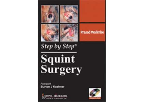 Step by Step: Squint Surgery