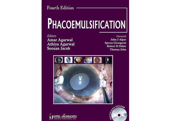 Phacoemulsification, Fourth Edition