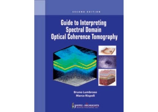 Guide to Interpreting Spectral Domain Optical Cohe