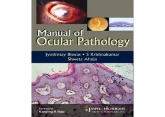 Manual of Ocular Pathology