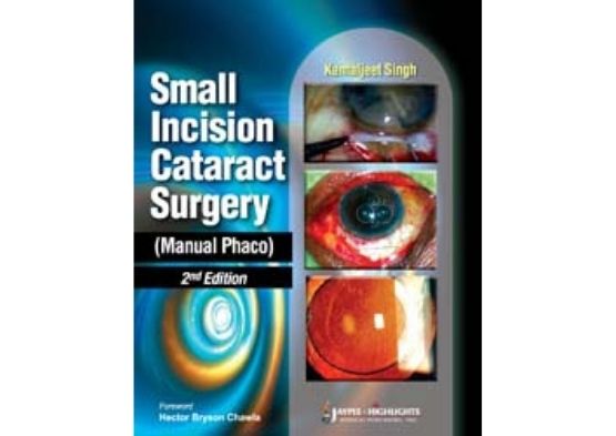 Small Incision Cataract Surgery (Manual Phaco)