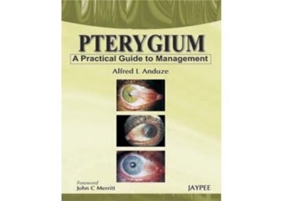 Pterygium - A Practical Guide to Managemen