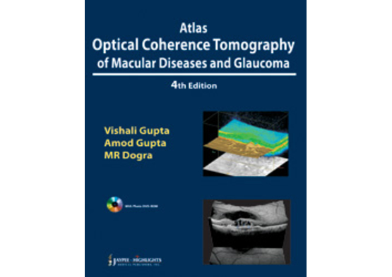 Atlas ? Tomograf?a de Coherencia ?ptica en Patolog