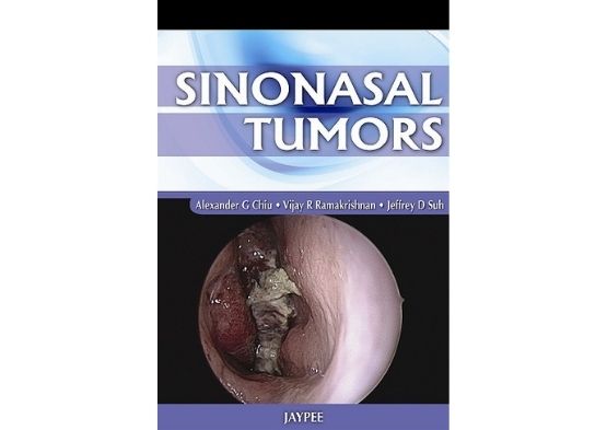 Sinonasal Tumors