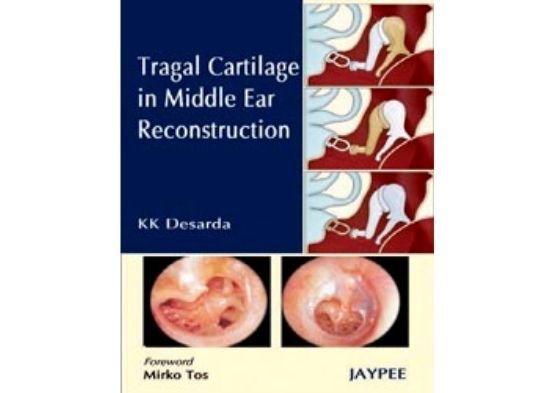 Tragal Cartilage in Middle Ear Reconstruction