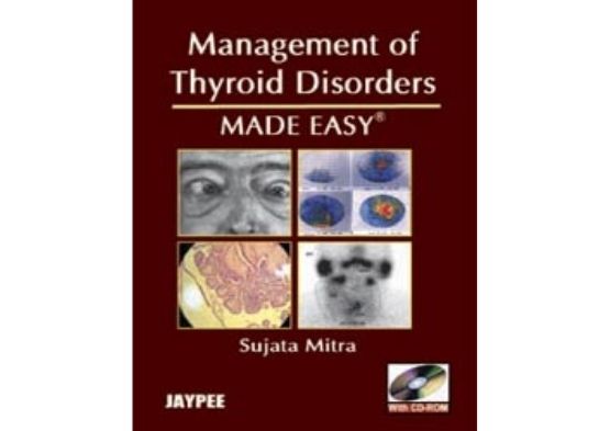 Management of Thyroid Disorders Made Easy