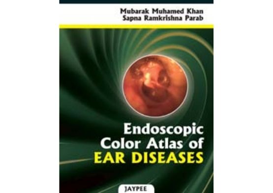 Endoscopic Color Atlas of Ear Diseases