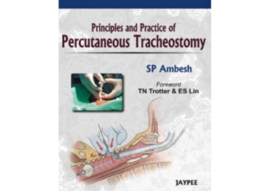 Principles and Practice of Percutaneous Tracheosto