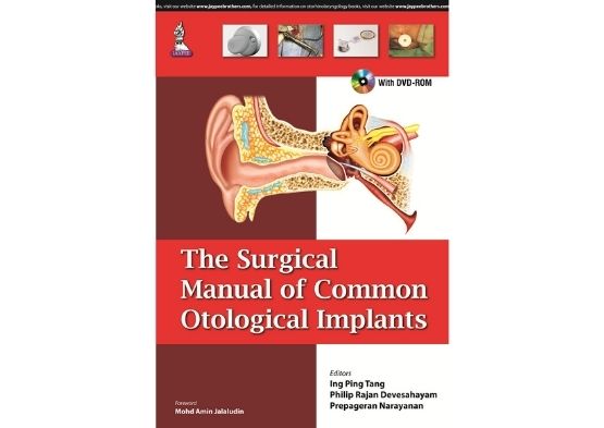 The Surgical Manual of Common Otological Implants